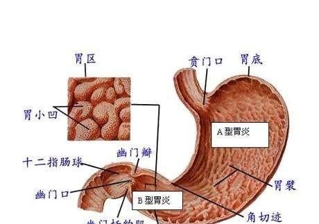 浅表性胃炎图1