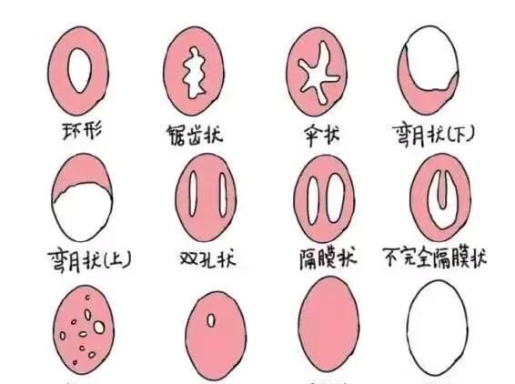 内置式卫生棉条，初中生可以用卫生棉条吗图3