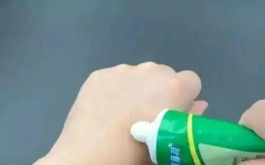 洋辣子蛰后处理，被洋辣子蛰了怎么办图5