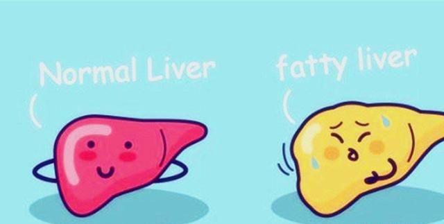 脂肪肝怎么治图1