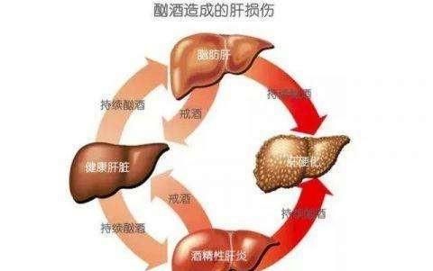 脂肪肝怎么治图3