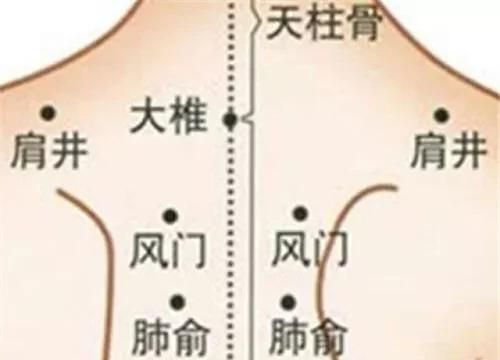 背后长痘痘是什么原因，前胸和后背都长痘痘,你知道是什么原因吗图6