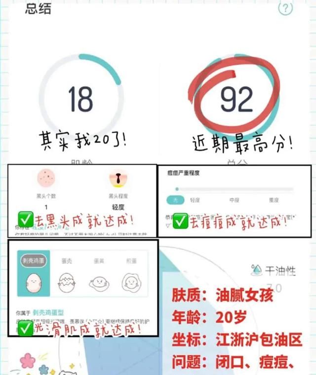 去粉刺印，怎样去粉刺和黑头粉刺图2