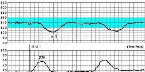 胎心率多少是男孩，男宝胎心率一般多少正常图2