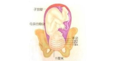 内检怎么检查，孕期做内检是为了检查什么项目图3