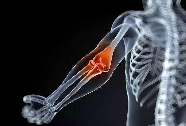 胳膊肘外侧尺骨疼是怎么回事?应该注意哪些健康问题图1