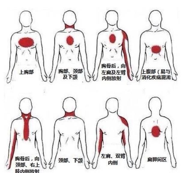 上腹部疼痛是什么原因如何应对图8