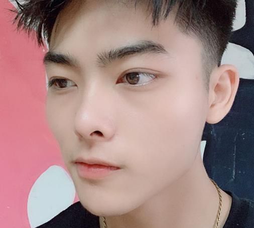 鼻子垫了会好看很多吗图12
