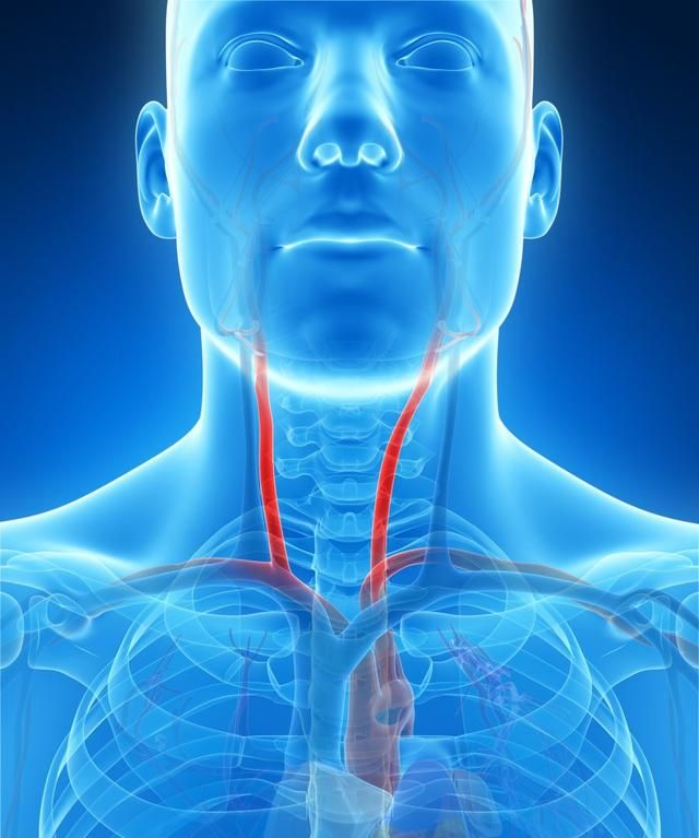 颈动脉窦，颈动脉在哪个位置图片图1