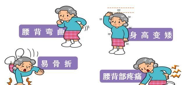 什么样的人容易得骨质疏松图1