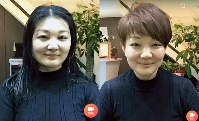 额头高头发少怎么办，脸大头发少发际线高适合什么发型图4