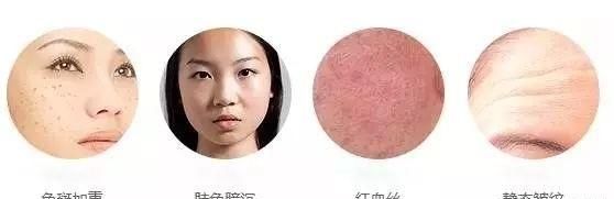 你做过哪些可以有效美容的医美项目图9