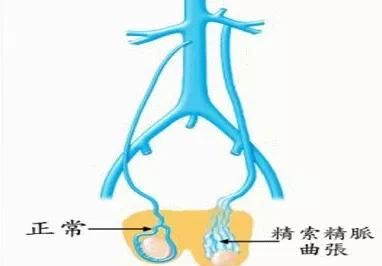 睾丸上长了一个小肉球硬硬的图3