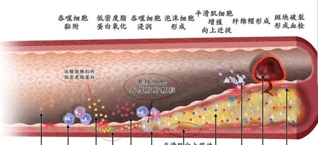 心梗前兆有哪些症状表现图7