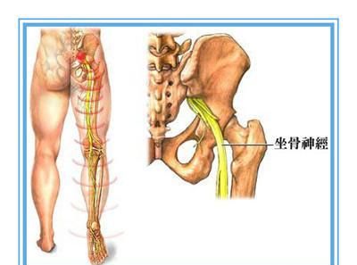 大腿按摩器，大腿肌肉神经疼痛,有什么按摩器可用呢图1