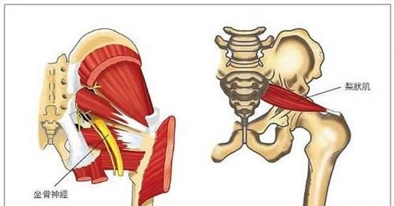 大腿按摩器，大腿肌肉神经疼痛,有什么按摩器可用呢图2