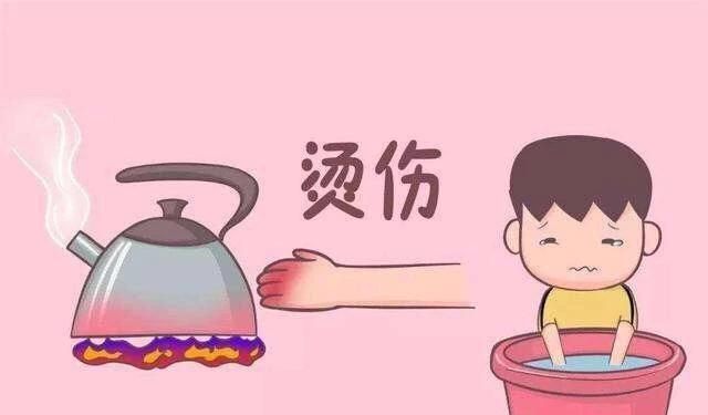 烫伤怎么办?图3