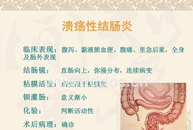 小肠癌的早期症状，肠癌早期有什么症状表现图8