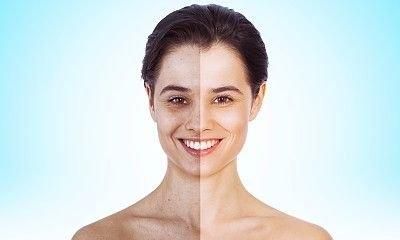 牛奶冰砖美容法有用吗，就是把牛奶冻成冰块冰冻身体，美白效果很好听说图3