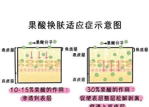 果酸换肤霜，果酸换肤的效果怎么样图3