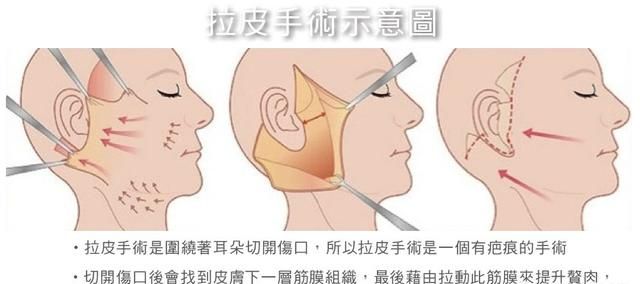 14岁有皱纹该怎么办图10