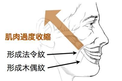 鼻唇沟纹，鼻唇沟和法令纹是一样的吗女生图4