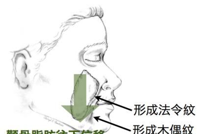 鼻唇沟纹，鼻唇沟和法令纹是一样的吗女生图5