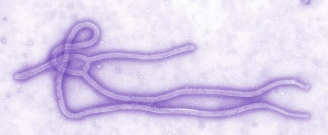 埃博拉病毒传播途径，埃博拉病毒是什么形状的?图2