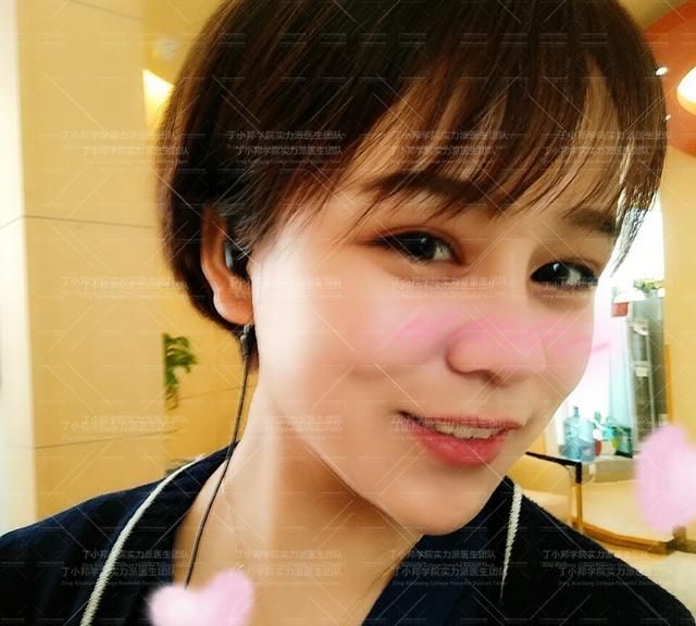 脂肪填充多久能恢复，自体脂肪填充一般可以保持多久图2