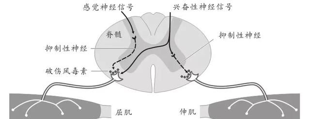 脚被钉扎了需不需要打针消炎图1