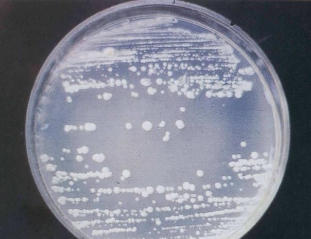 白色念珠菌感染，白色念珠菌是什么病图1