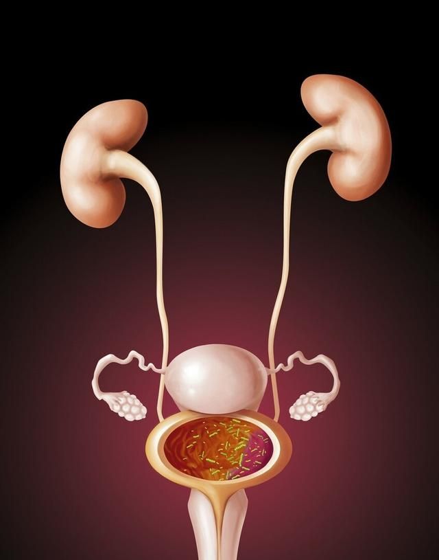 急性膀胱炎是什么感觉图1