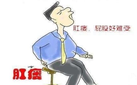 治疗肛瘘有什么好方法官网
