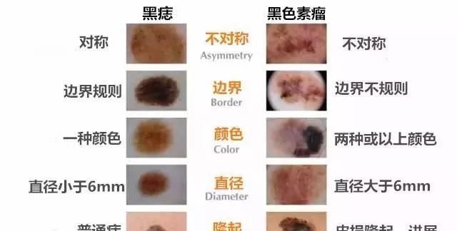 皮肤癌治疗，食疗如何有效治疗皮肤癌症图2