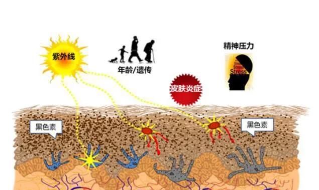 皮肤变黑，为什么皮肤这么黑,怎么样才能变白图4