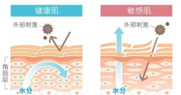 红血丝皮肤的保养，红血丝皮肤怎样护养图5