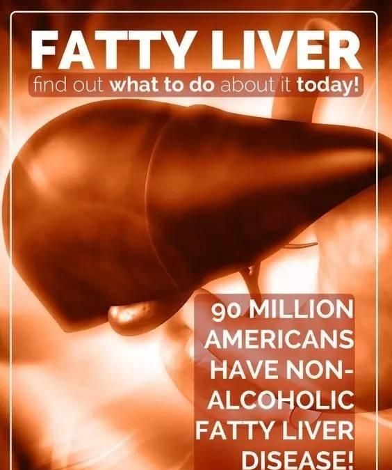 脂肪肝 饮食，脂肪肝患者吃什么食物最好图1