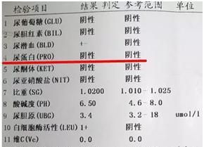 尿蛋白是怎么检测出来的(尿蛋白是检测什么的)图1