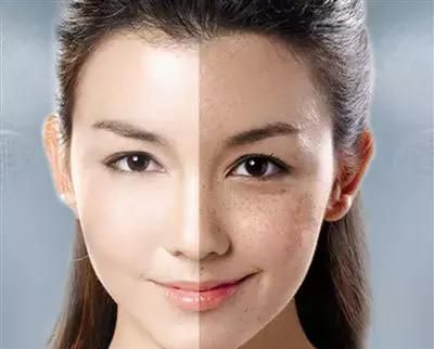 干货｜号称什么皮肤都能治的激光美肤，真有这么强？