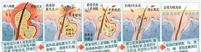 干货｜号称什么皮肤都能治的激光美肤，真有这么强？