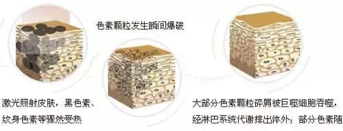 干货｜号称什么皮肤都能治的激光美肤，真有这么强？
