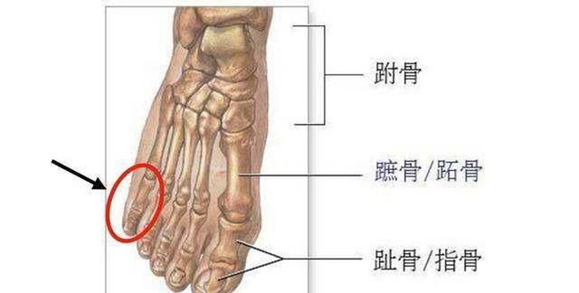 人体共有206块骨头，中国人却普遍只有204块，少的两块哪儿去了？