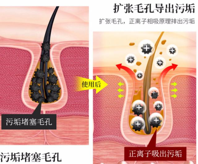 女生最好不要去美容院，业内人士揭露内幕，没留“后遗症”真幸运