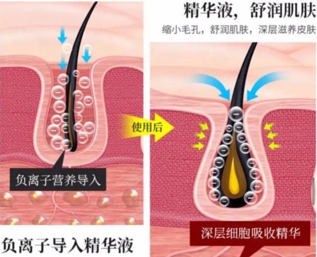 女生最好不要去美容院，业内人士揭露内幕，没留“后遗症”真幸运