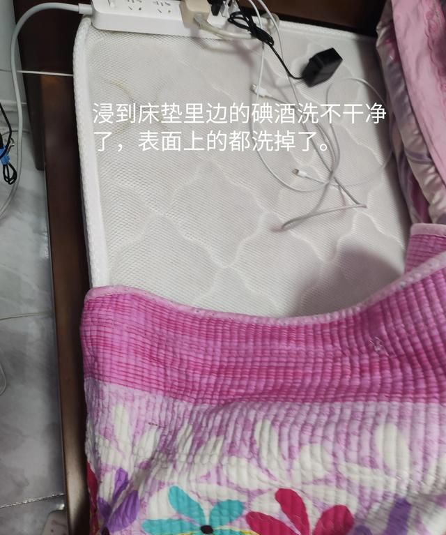 洒在床单上的碘酒洗干净了！