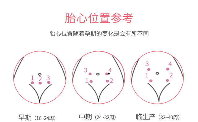 第一次用康泰胎心仪监测胎心，老公高兴地说：你肚子里有个小马达