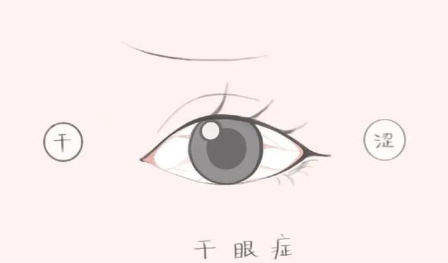 上海市眼病防治中心的这项“黑科技”，既能治疗“干眼症”，又可美肤