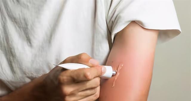 红霉素软膏很常见，但它主要是治疗什么病？5种小问题用它或有效