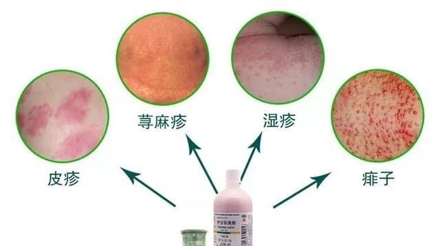 炉甘石的用途有什么,炉甘石的用途图3