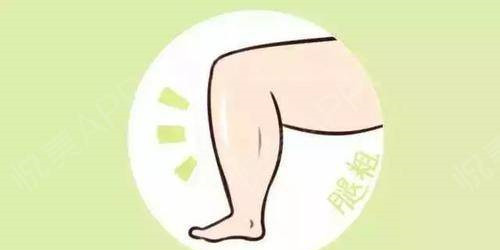 韩啸医生解析大腿吸脂手术的安全性及注意问题